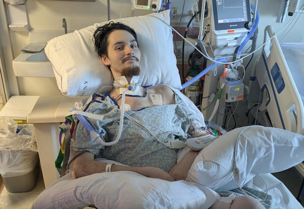 Hospitalized individual with a tracheostomy tube reclines in a bed, covered with white sheets, as electronic medical equipment and wires are visible nearby, conveying a serious medical situation.
