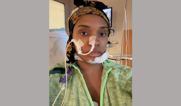 Patient dressed in a hospital gown and headwrap, looking directly at the camera while connected to nasal and facial medical tubes in a clinical room.